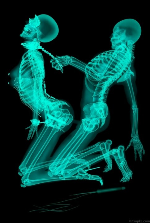 X Ray Porn Pics 88