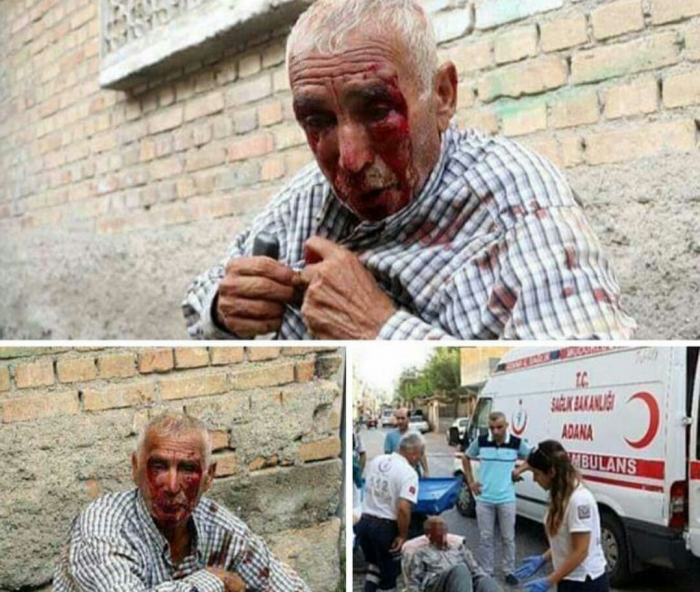 77 yaşındaki adamı dövüp parasını çalmak