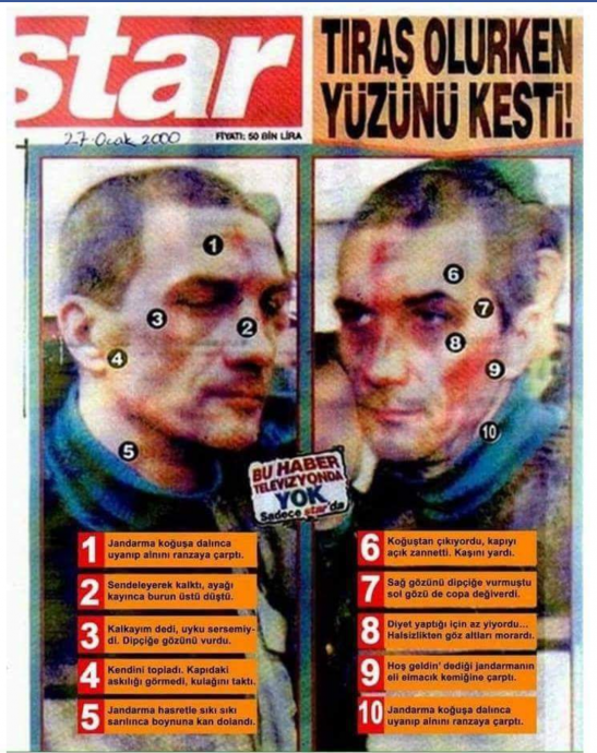 tıraş olurken yüzünü kesti