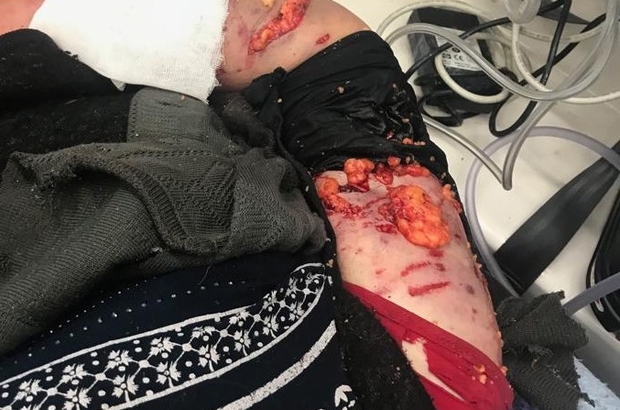 9 u birden saldırdı vücudumda kan bırakmamışlar