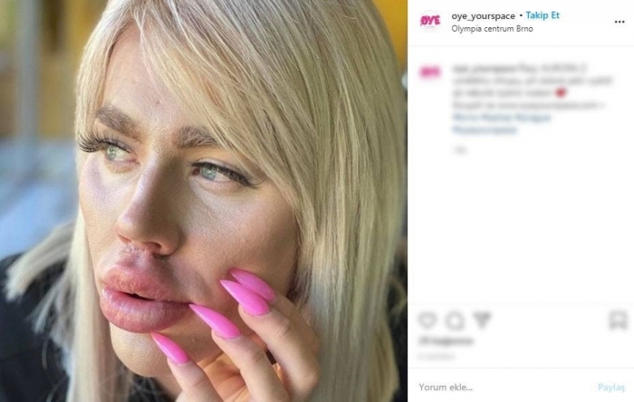 barbie ye benzemek için 150 bin lira harcayan adam