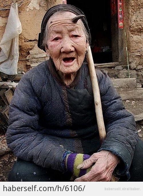 Kafasında Boynuzla Yaşayan Yaşlı Kadının 6 Akılalmaz Fotoğrafı