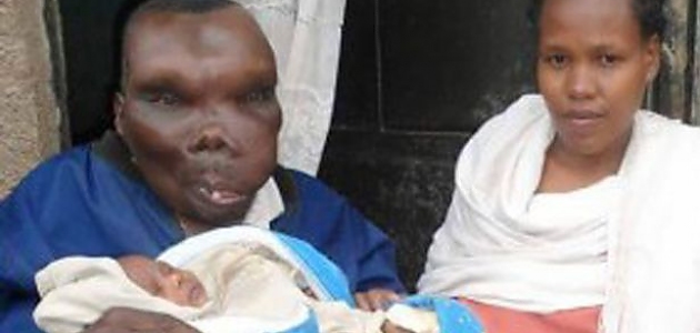8. Kez Baba Olma Sevinci Yaşayan, Uganda'nın En Çirkin Adamının 5 Fotoğrafı