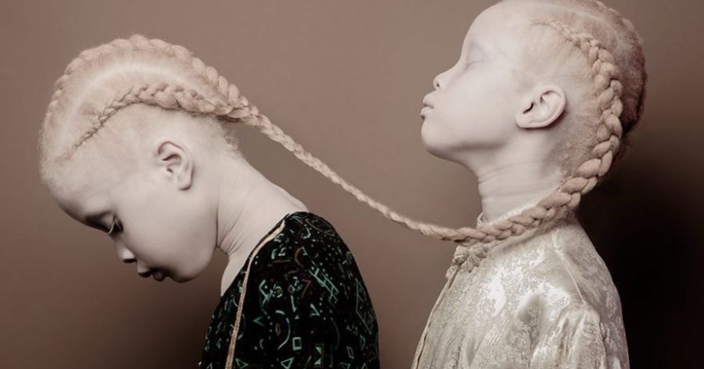 Modelliğe Bambaşka Bir Boyut Getiren Albino İkizlerin 11 Güzel Fotoğrafı