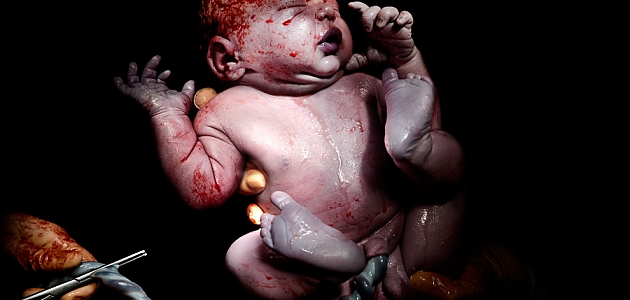 Doğumlarından Saniyeler Sonra Fotoğrafları Çekilmiş 8 Yeni Doğmuş Bebek