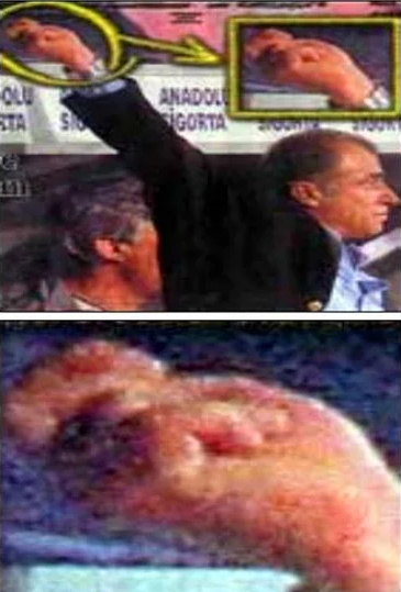 galatasaray efsanesi fatih terim in vukuatları