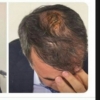 şenol güneş in yarığı vs skrtel in yarığı / #1671584