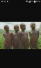 koteka sendromu afrikanin 3 ayak sorunsali / #1447082