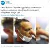 ozan güven in paylaştığı darp fotoğrafı / #2050674