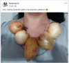 patates ekmiş altın biçmiş bebem / #1697103