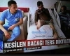 kesilen bacağın ters şekilde dikilmesi / #2003147