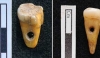 çatalhöyük te keşfedilen 8500 yıllık insan dişleri / #1949503