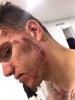 ederson moraes / #1530029