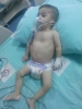 epilepsi osteoporoz ve duyma engelli mehmet bebek / #1604716