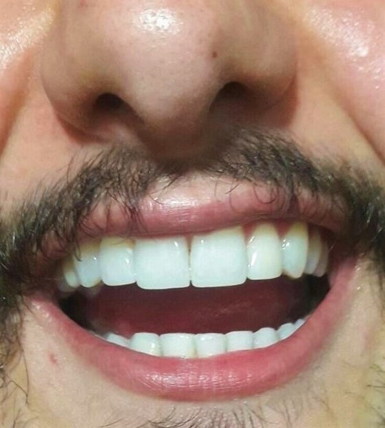 diş teli sayfa 43 uludağ sözlük