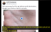 google / #2438842