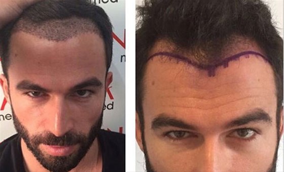 serkan aydın 1027851 uludağ sözlük galeri