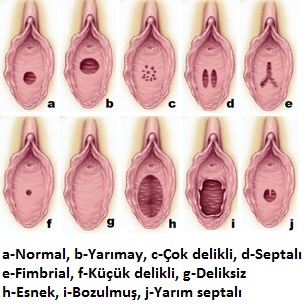 Nasıl Hamile Kalınır Zenci Bakire Kız